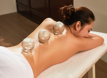 Cupping Therapy